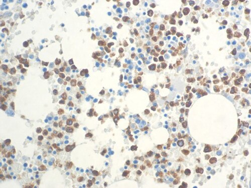 IHC of Myeloperoxidase Rpab on an FFPE Bone Marrow Tissue